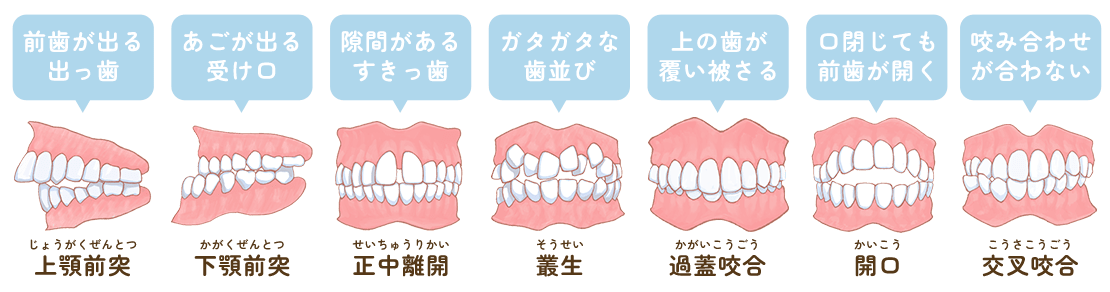 歯並び