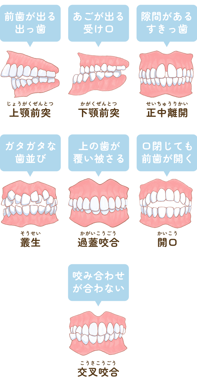 歯並び