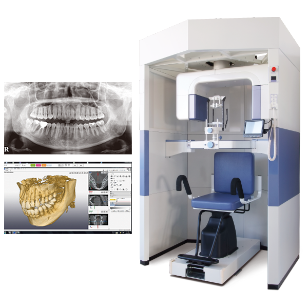 歯科用CT
